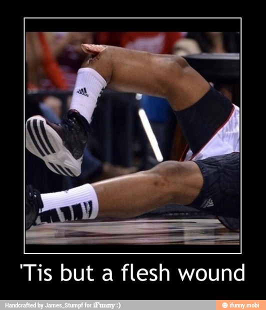 "Tis but a flesh wound - 'Tis but a flesh wound