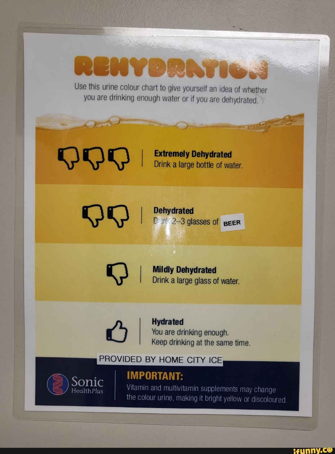 Use this urine colour chart to give yourself an idea of whether you are drinking enough water or