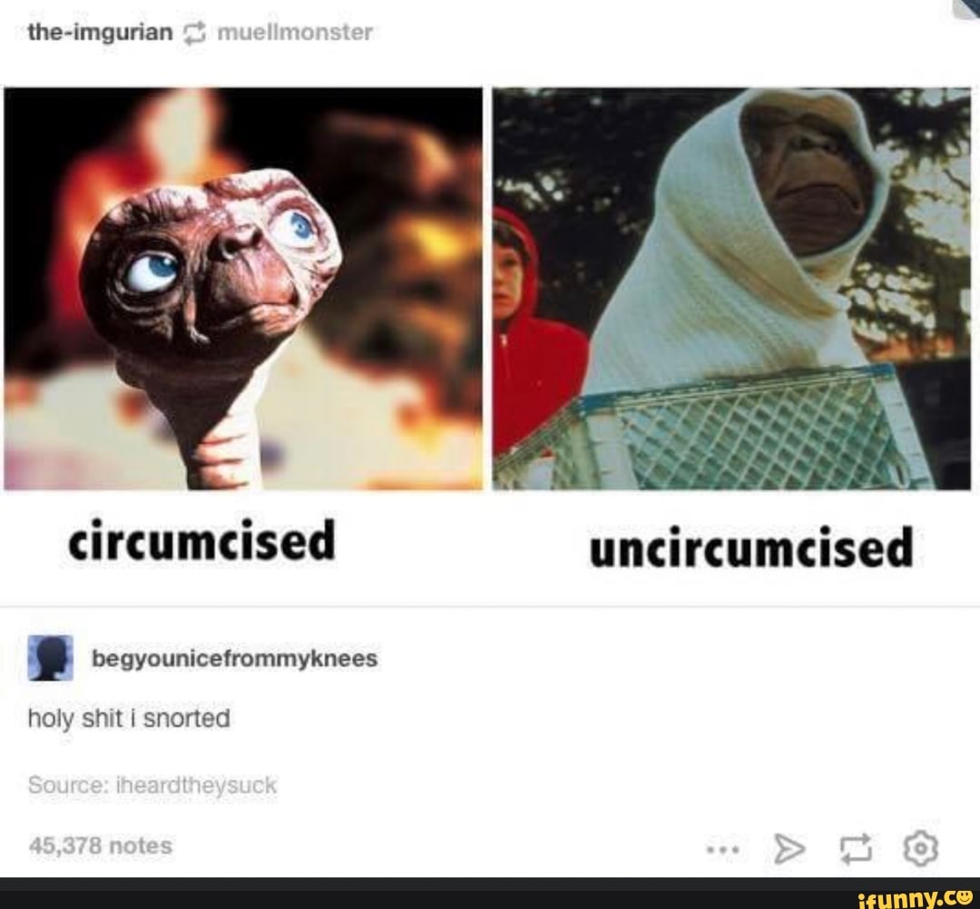 My dick doesn't look like it was circumcised right