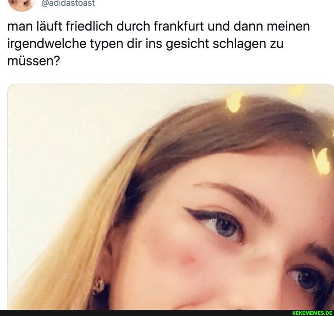 man läuft friedlich durch frankfurt und dann meinen irgendwelche typen dir ins gesicht schlagen zu müssen?