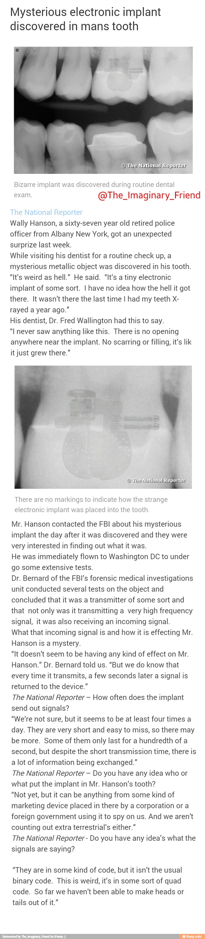 Mysterious electronic implant discovered in mans tooth National Bizarre