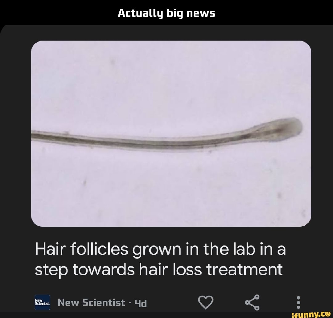 Actually big news Hair follicles grown in the lab ina step towards hair