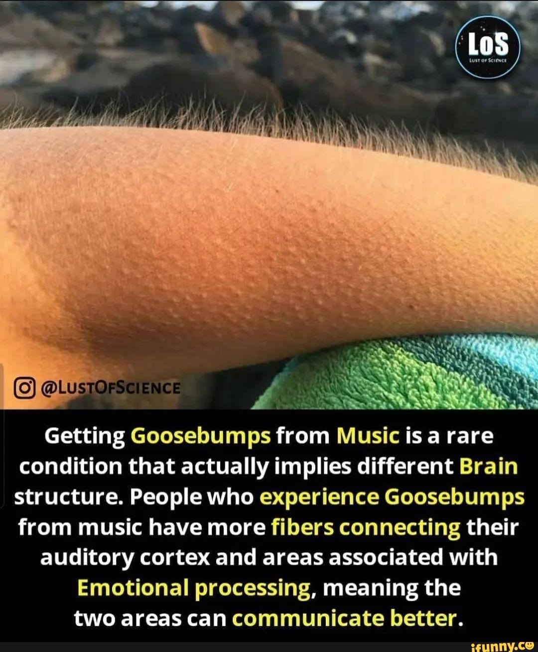 los-getting-goosebumps-from-music-is-a-rare-condition-that-actually