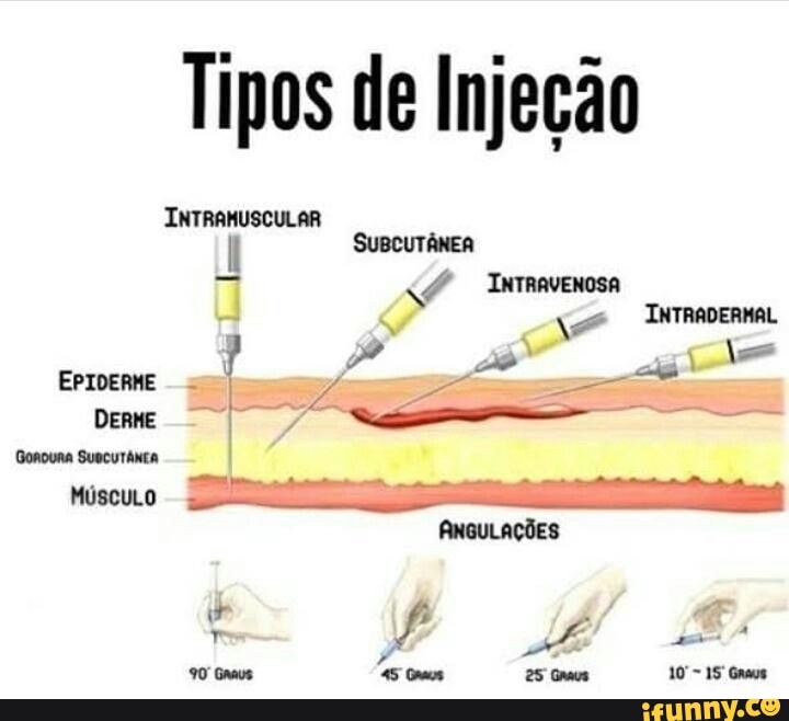 Tipos de Injeção INTRAMUSCULAR SUBCUTÂNEA I