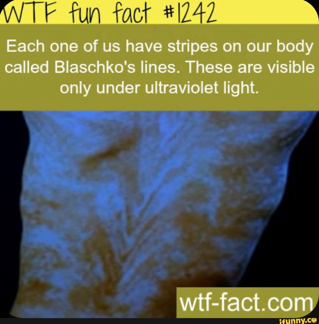 Fun #1242 Each one of us have stripes on our body called Blaschko's ...