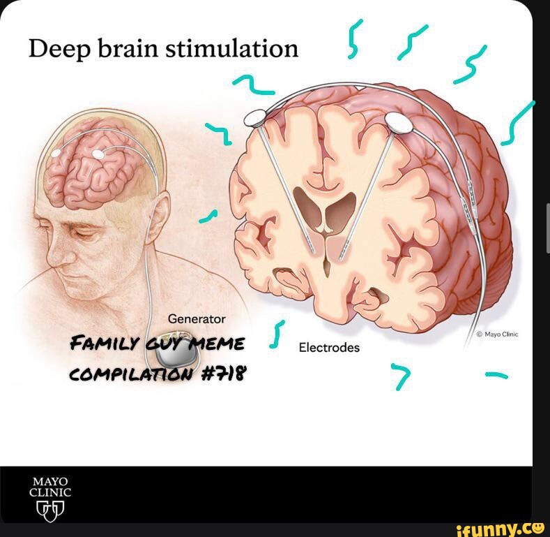Deep brain stimulation ( Ky Generator FAMILY GUY MEME Electrodes ...