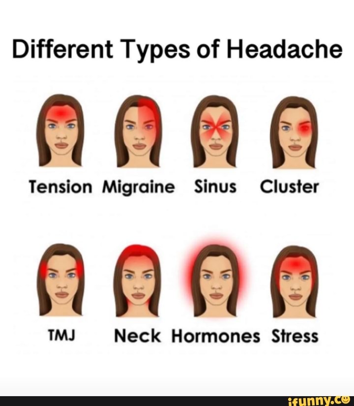 Different Types of Headache AAA Tension Migraine Sinus Cluster Tension ...