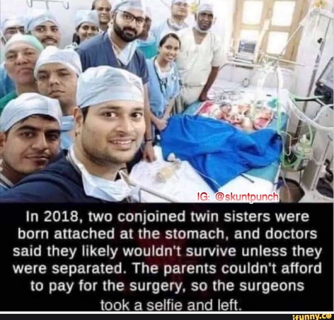 In 2018, two conjoined twin sisters were born attached at the stomach, and doctors said they likely wouldn't survive unless they were separated. The parents couldn't afford to pay for the surgery, so the surgeons took a selfie and left.