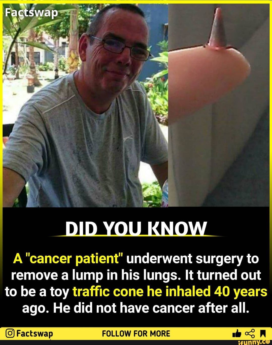 Factswap DID YOU KNOW A "cancer Patient" Underwent Surgery To Remove A ...