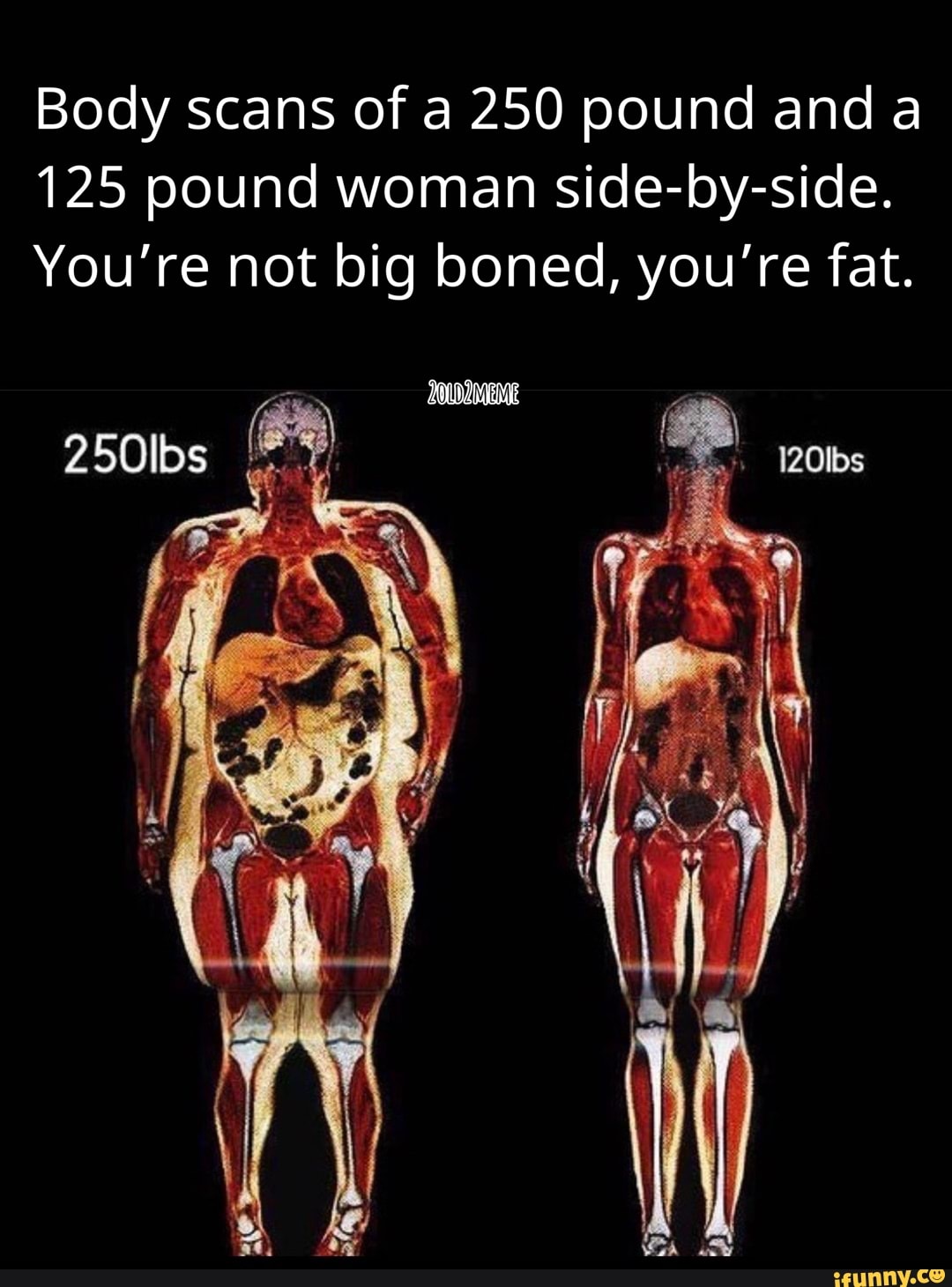 Весы withings body scan. Сканирование тела витингс. Весы withings body scan. Withings body scan © withings. Withing body scan.