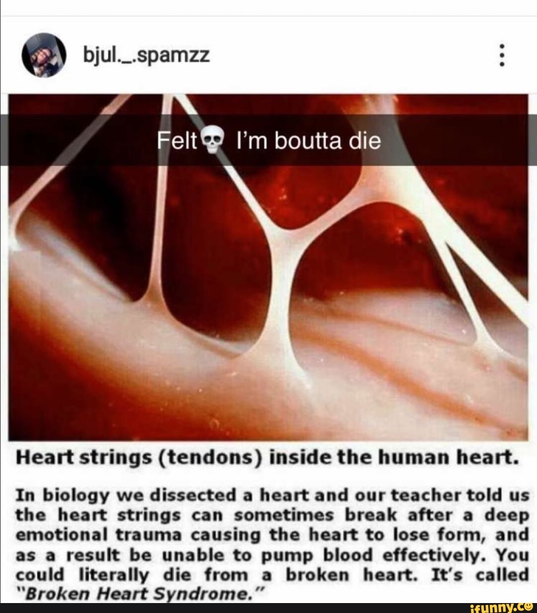 Few I’m boutta die -' 1 Heart strings (tendons) inside the human heart