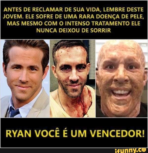 ANTES DE RECLAMAR DE SUA VIDA, LEMBRE DESTE
JOVEM. ELE SOFRE DE UMA RARA DOENÇA DE PELE,
MAS MESMO COM O INTENSO TRATAMENTO ELE
NUNCA DEIXOU DE SORRIR
RYAN VOCÊ É UM VENCEDOR!