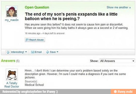 Open Question Show me another The end of my son's penis exspands like a little
mpmason
Dalloon when he is peeing.?
Has anyone seen this before? It does not seem to cause him pain or discomfort.
When we were giving him his baby baths it always gave us a second or 2 of waming
Answers (5) Show: All Answers
description given. However, Im sure
I could make a diagnosis i you sent me some
pictures
Source(s):
Medical School
pa Hmm... dont think I can determine your son's problem based solely on the
ATotaly
Real Doctor