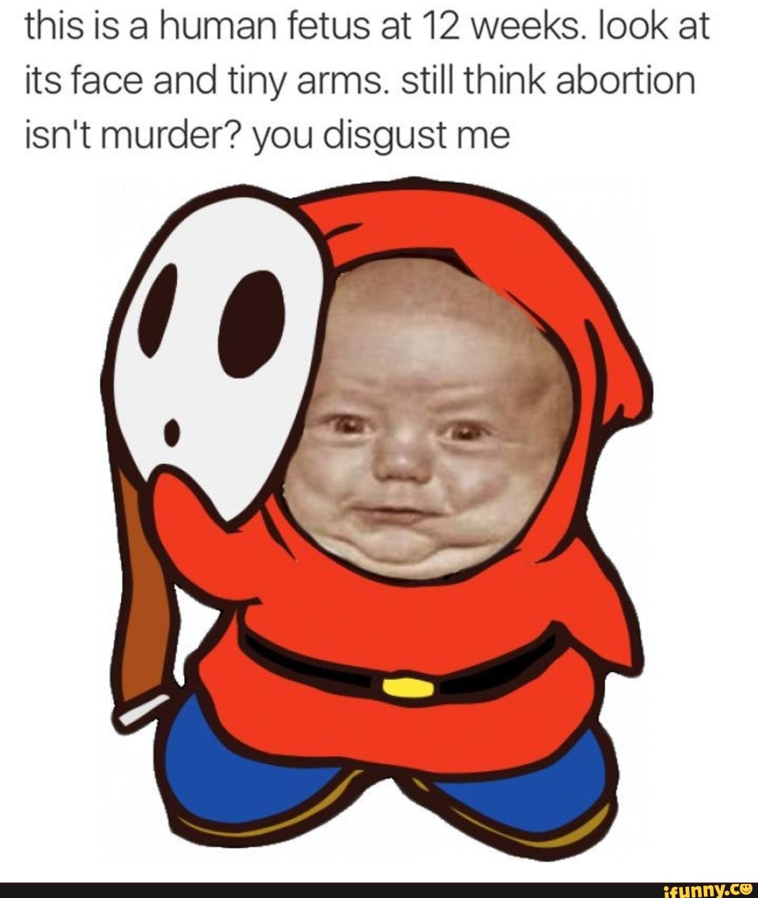 This Is A Human Fetus At 12 Weeks Look At Its Face And Tiny Arms