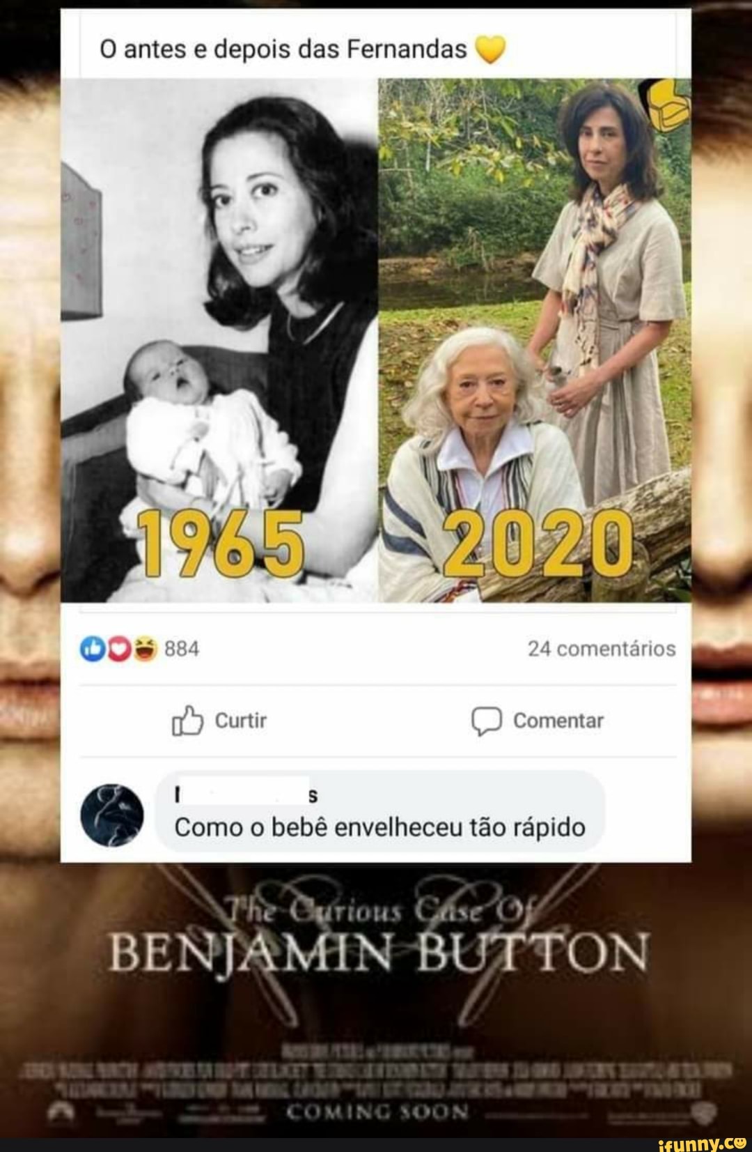 O antes e depois das Fernandas
894 24 comentários
Curtir Comentar -
I s
Como o bebê envelheceu tão rápido
BENJAMIN BUTTON