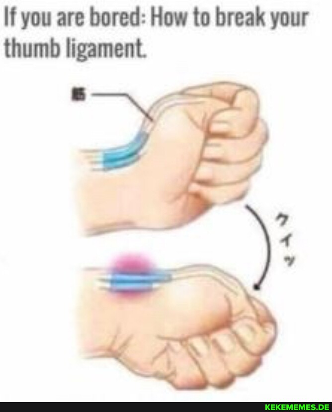 If you are bored: How to break your thumb ligament.