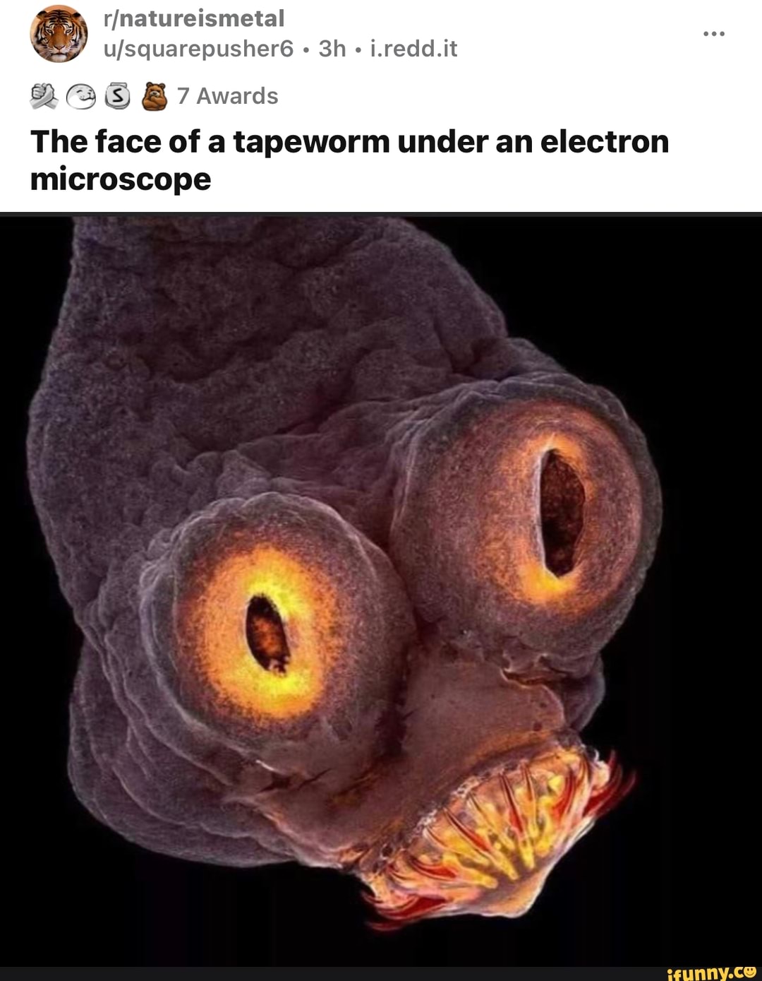 " Sh i.redd.it
& 7 Awards
The face of a tapeworm under an electron microscope