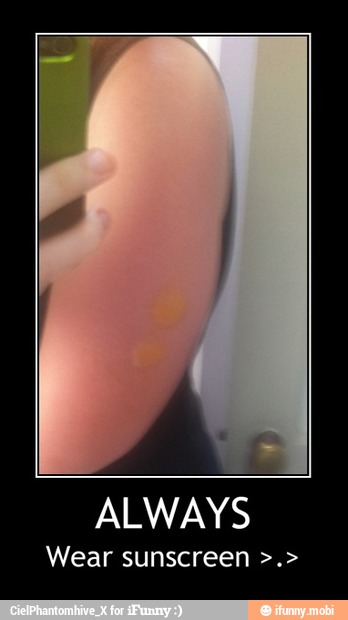ALWAYS
Wear sunscreen - ALWAYS
Wear sunscreen >.>