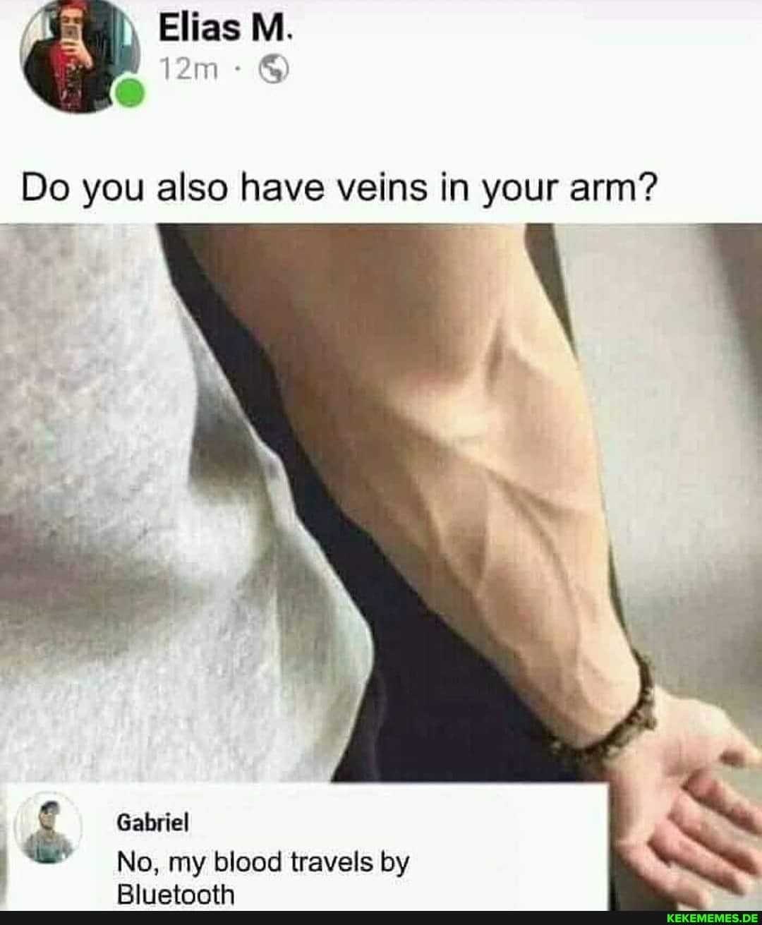 Elias M.
Do you also have veins in your arm?
Gabriel
No, my blood travels by
Dhintanth