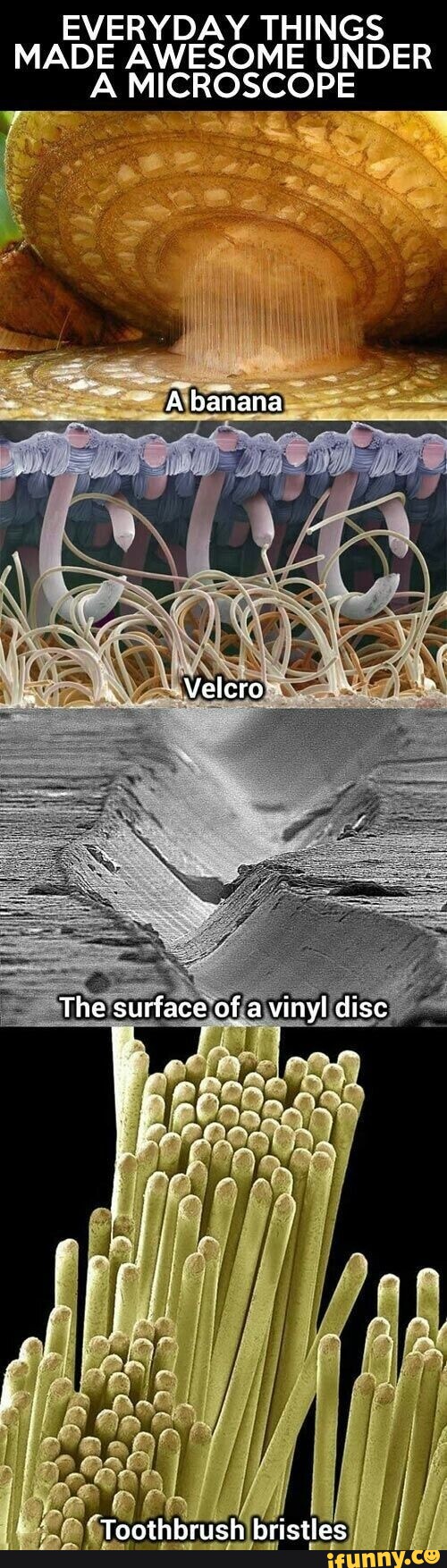 EVERYDAY THINGS MADE AWESOME UNDER A MICROSCOPE Abanana Vii Velcro The ...