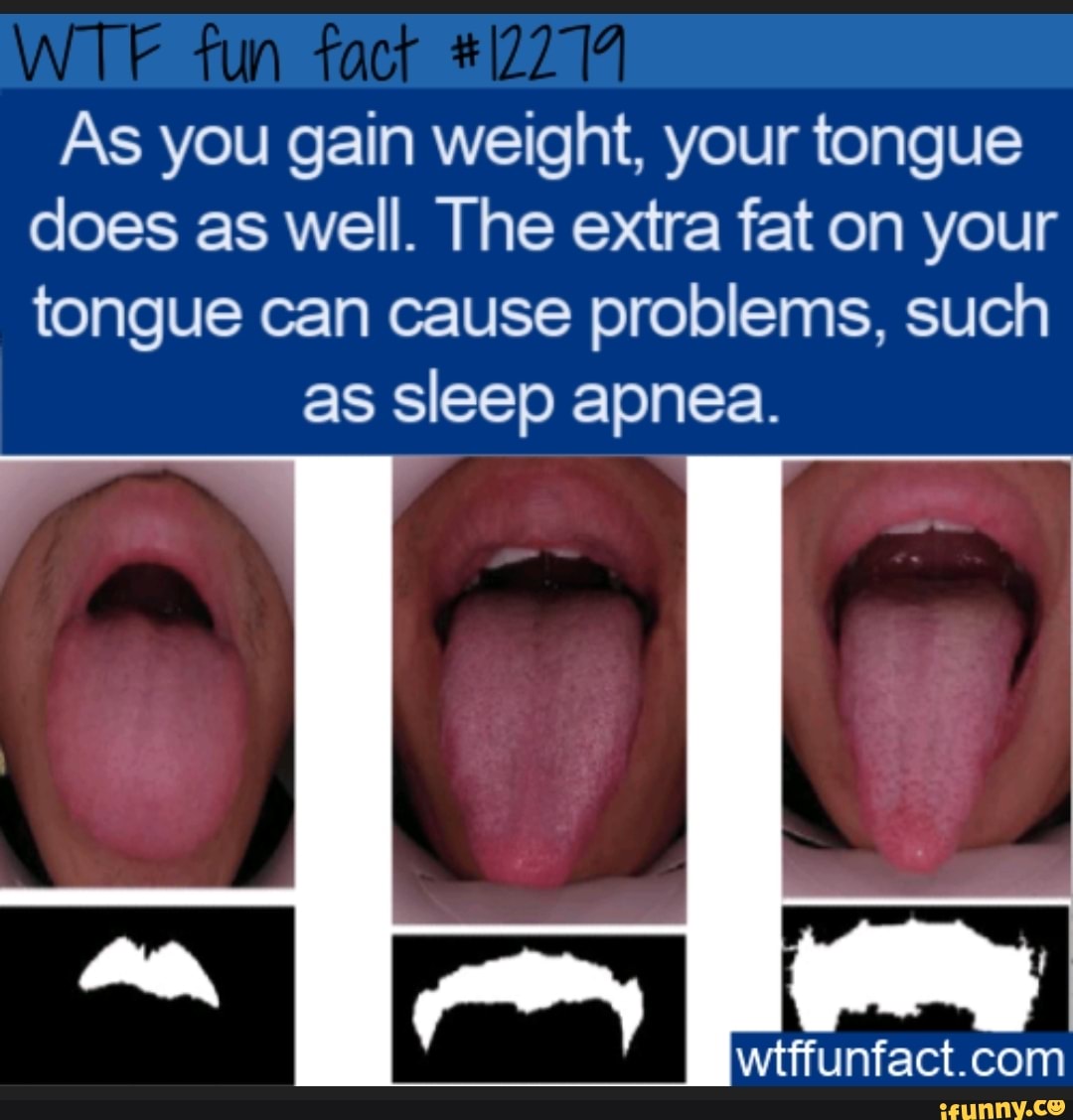 WT "un As you gain weight, your tongue does as well. The extra fat on