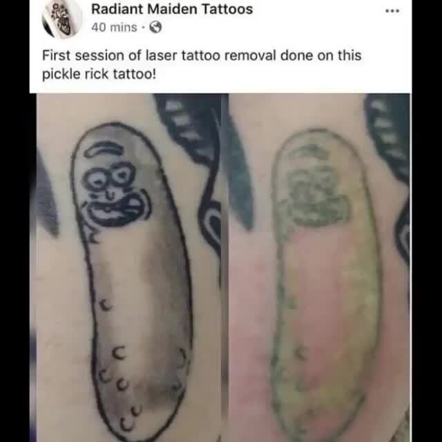 Get Pickle Rick Tattoo Removal Pictures