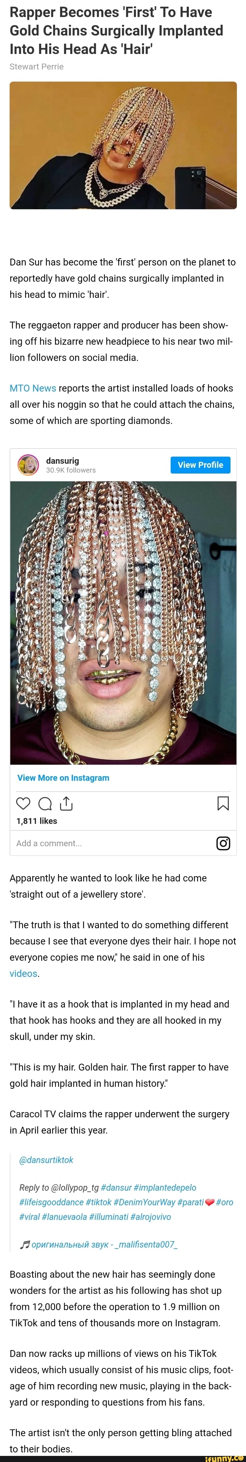 Rapper 'First' To Have Gold Chains Surgically Implanted Into