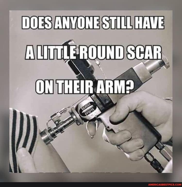 DOES ANYONE STILL HAVE ALITTLE ROUND SCAR ON THEIR ARM?