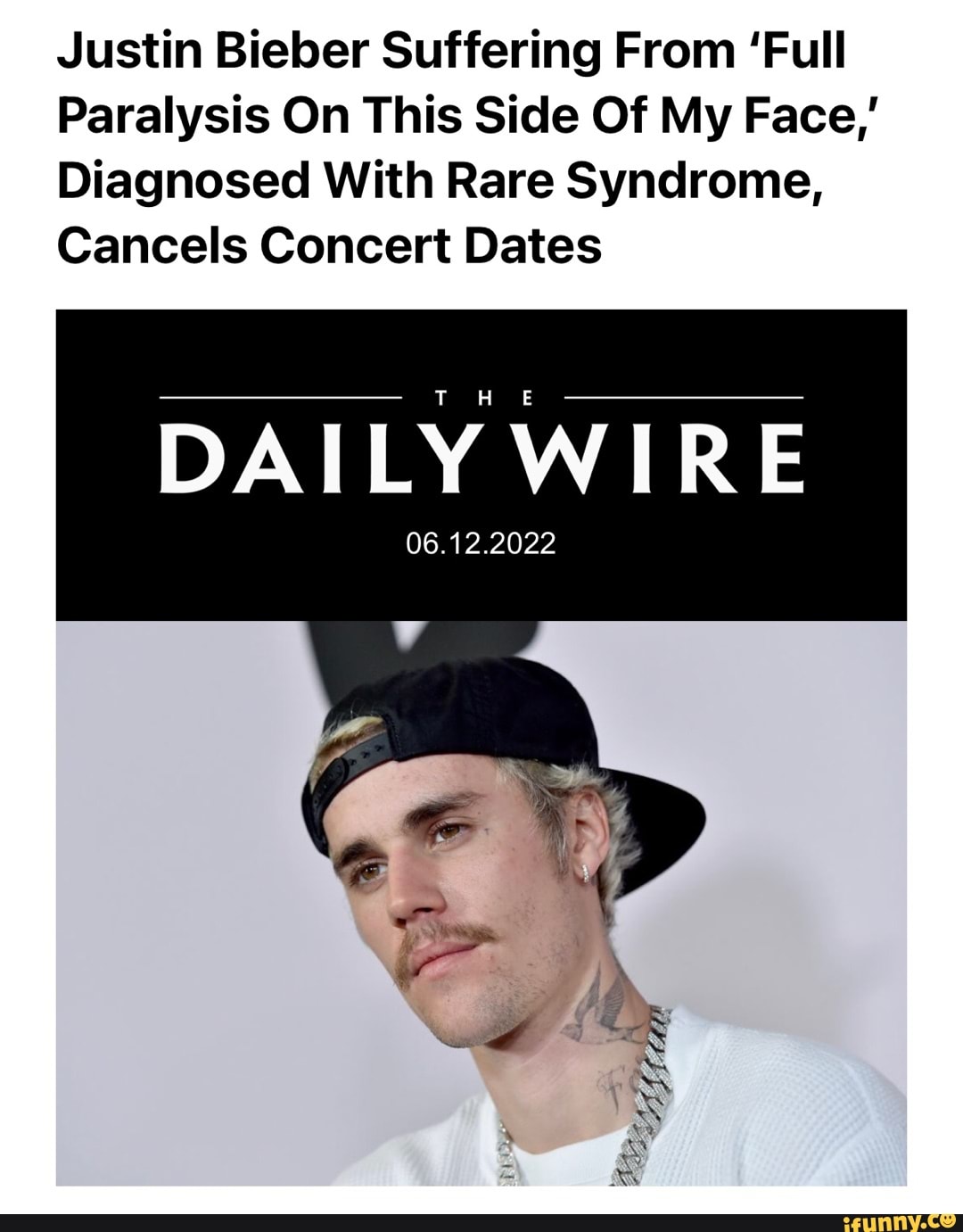 Justin Bieber Suffering From Full Paralysis On This Side Of My Face justin-bieber-suffering-from-full-paralysis-on-this-side-of-my-face