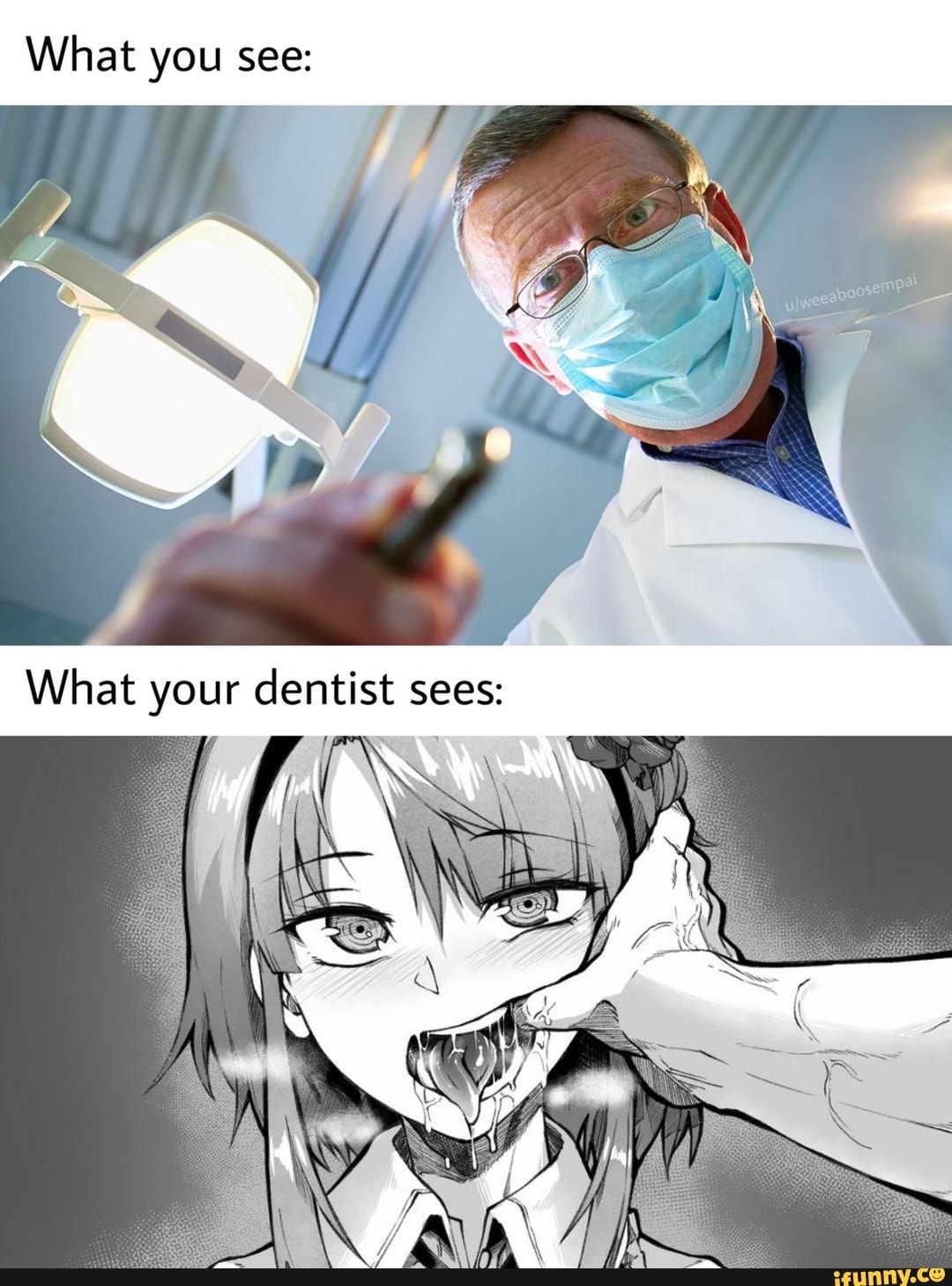 what-you-see-what-your-dentist-sees-ifunny