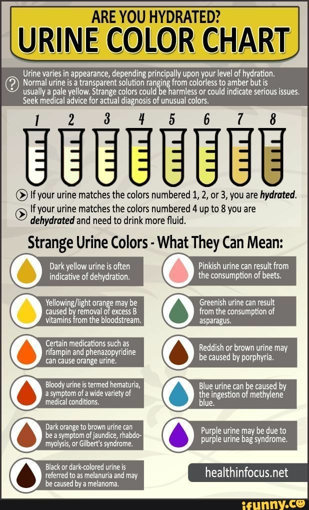 ARE YOU HYDRATED? URINE COLOR CHART Urine varies in appearance