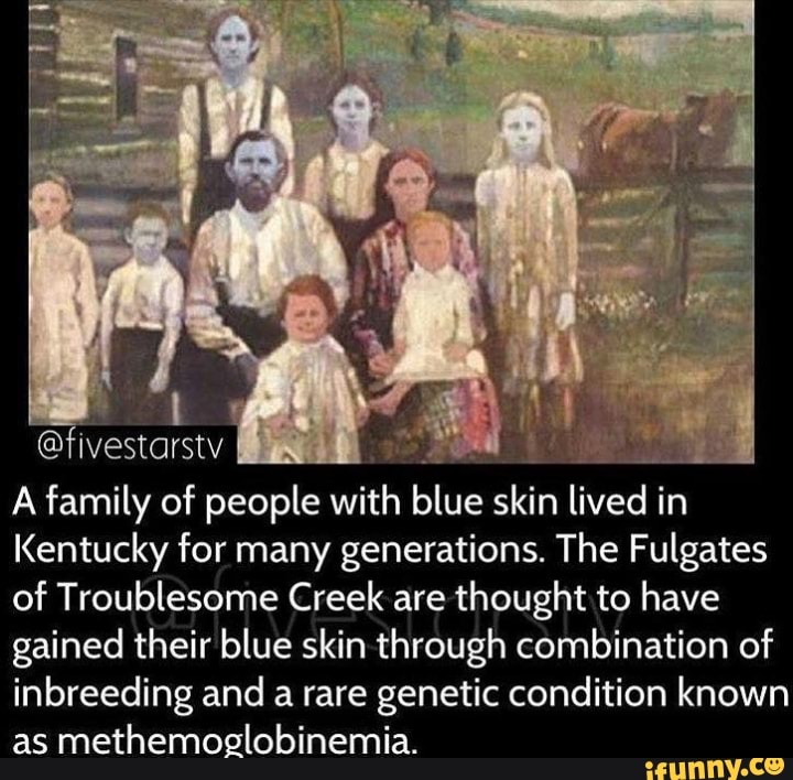 Inbred People Blue Skin