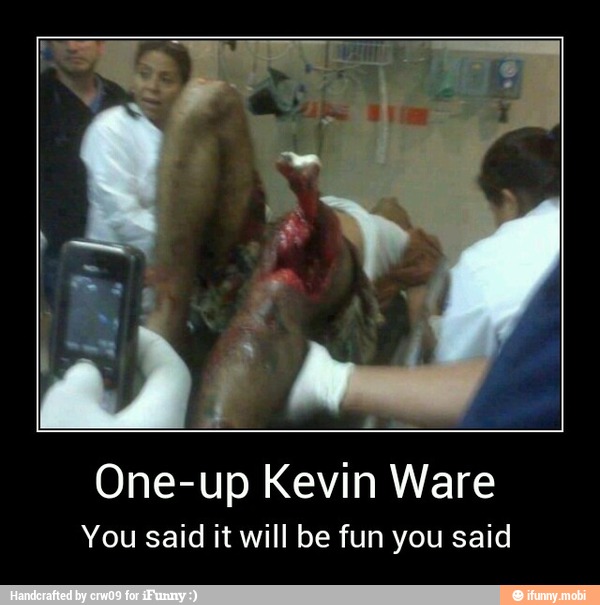 One-up Kevin Ware
You said it will be fun you said - One-up Kevin Ware
You said it will be fun you said