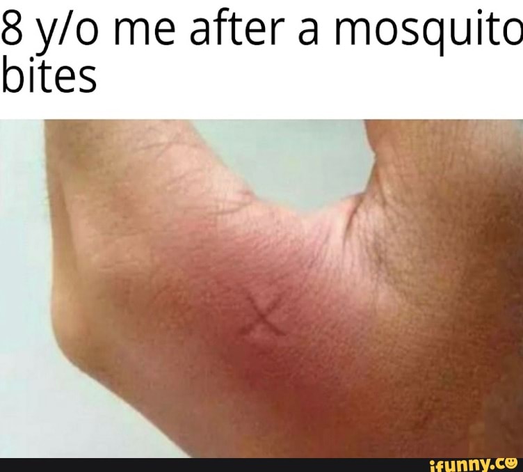 8 me after a mosquito bites