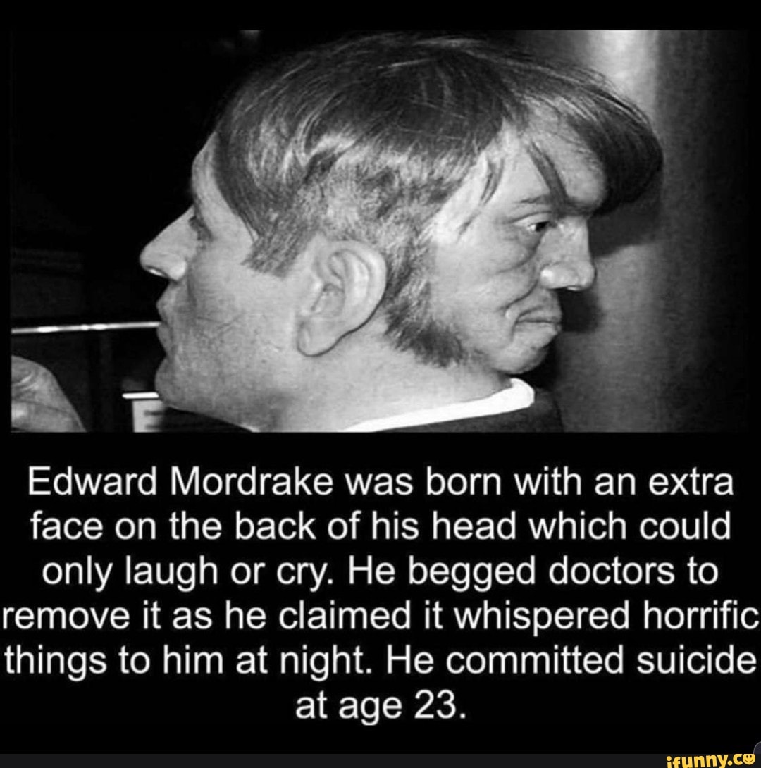 Edward Mordrake was born with an