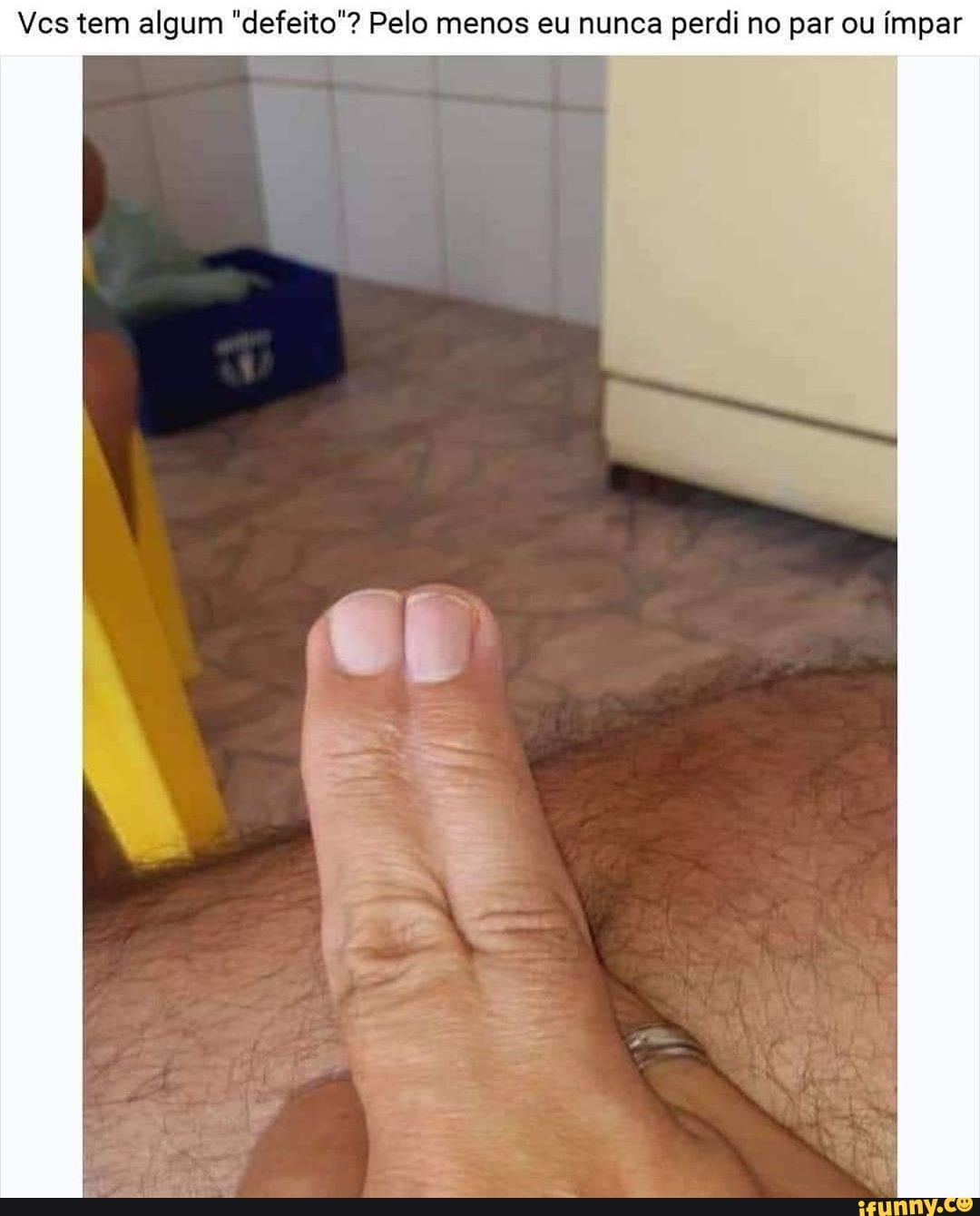Ves tem algum "defeito"? Pelo menos eu nunca perdi no par ou ímpar