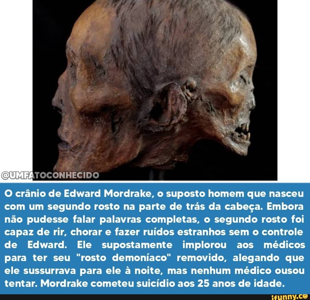 O crânio de Edward Mordrake, o suposto homem que nasceu com um segundo rosto na parte de trás da cabeça. Embora não pudesse falar palavras completas, o segundo rosto foi capaz de rir, chorar e fazer ruídos estranhos sem o controle de Edward. Ele supostamente implorou aos médicos para ter seu "rosto demoniaco" removido, alegando que ele sussurrava para ele à noite, mas nenhum médico ousou tentar. Mordrake cometeu suicídio aos 25 anos de idade.